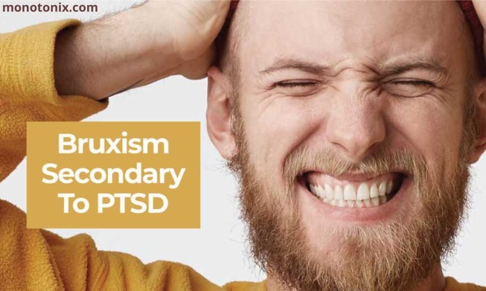 Bruxism and PTSD