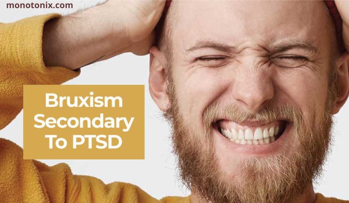 Bruxism and PTSD